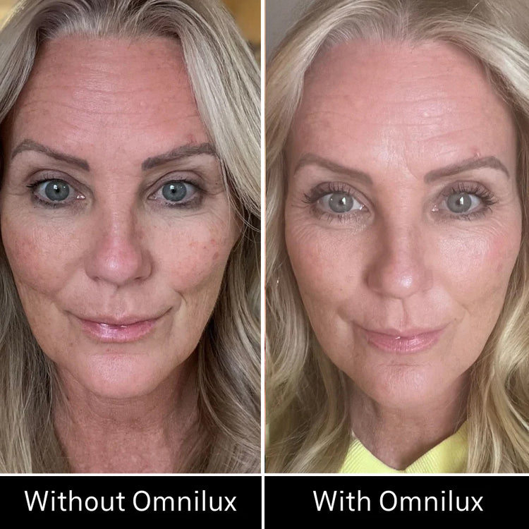 Omnilux Contour Face